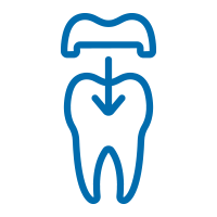corone dentali